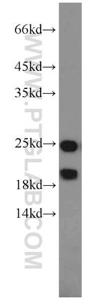 PARK7/DJ-1 Antibody in Western Blot (WB)