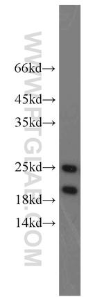 PARK7/DJ-1 Antibody in Western Blot (WB)