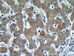 CYP4A11 Antibody in Immunohistochemistry (Paraffin) (IHC (P))