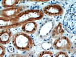 CYP4A11 Antibody in Immunohistochemistry (Paraffin) (IHC (P))