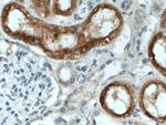 CYP4A11 Antibody in Immunohistochemistry (Paraffin) (IHC (P))