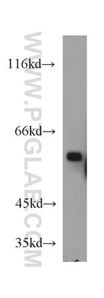 CYP4A11 Antibody in Western Blot (WB)