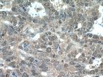 MLH1 Antibody in Immunohistochemistry (Paraffin) (IHC (P))