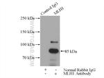 MLH1 Antibody in Immunoprecipitation (IP)