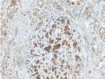 TSFM Antibody in Immunohistochemistry (Paraffin) (IHC (P))