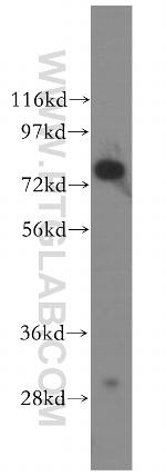 MCM5 Antibody in Western Blot (WB)