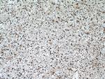 CDK9 Antibody in Immunohistochemistry (Paraffin) (IHC (P))