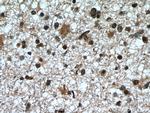 CDK9 Antibody in Immunohistochemistry (Paraffin) (IHC (P))