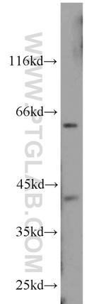 CDK9 Antibody in Western Blot (WB)