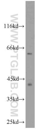 CDK9 Antibody in Western Blot (WB)