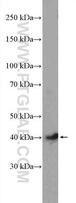 CDK9 Antibody in Western Blot (WB)