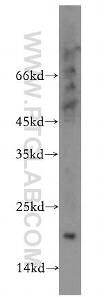 MRPL23 Antibody in Western Blot (WB)