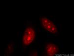 DNAJB6 Antibody in Immunocytochemistry (ICC/IF)