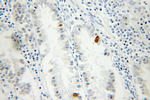 DNAJB6 Antibody in Immunohistochemistry (Paraffin) (IHC (P))