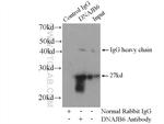 DNAJB6 Antibody in Immunoprecipitation (IP)