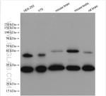 DNAJB6 Antibody in Western Blot (WB)