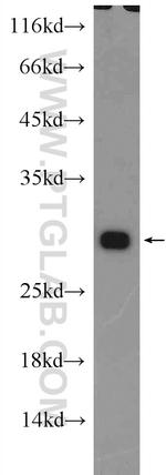 DNAJB6 Antibody in Western Blot (WB)