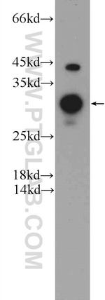 DNAJB6 Antibody in Western Blot (WB)