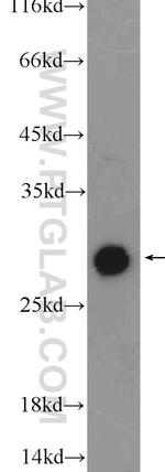 DNAJB6 Antibody in Western Blot (WB)