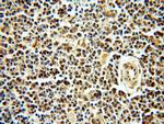 SMN Antibody in Immunohistochemistry (Paraffin) (IHC (P))