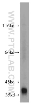 SMN Antibody in Western Blot (WB)