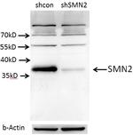 SMN Antibody in Western Blot (WB)