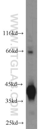 SMN Antibody in Western Blot (WB)