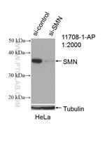 SMN Antibody in Western Blot (WB)