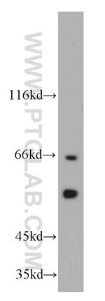 CSN1 Antibody in Western Blot (WB)