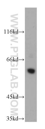 CSN1 Antibody in Western Blot (WB)