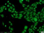 SSB Antibody in Immunocytochemistry (ICC/IF)