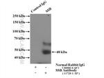 SSB Antibody in Immunoprecipitation (IP)