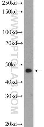 SSB Antibody in Western Blot (WB)