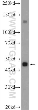 SSB Antibody in Western Blot (WB)