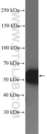 SSB Antibody in Western Blot (WB)