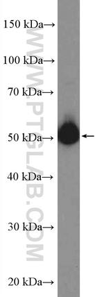 SSB Antibody in Western Blot (WB)