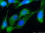 Maspin Antibody in Immunocytochemistry (ICC/IF)