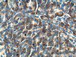 Maspin Antibody in Immunohistochemistry (Paraffin) (IHC (P))