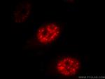 DDX39A Antibody in Immunocytochemistry (ICC/IF)