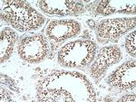 DDX39A Antibody in Immunohistochemistry (Paraffin) (IHC (P))