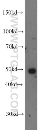 DDX39A Antibody in Western Blot (WB)