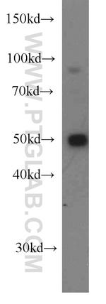 DDX39A Antibody in Western Blot (WB)