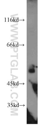 DDX39A Antibody in Western Blot (WB)