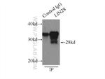 LIN28 Antibody in Immunoprecipitation (IP)