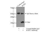 RAD1 Antibody in Immunoprecipitation (IP)