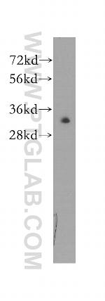 RAD1 Antibody in Western Blot (WB)