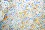 IFITM1 Antibody in Immunohistochemistry (Paraffin) (IHC (P))