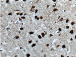 CUX1/Protein CASP Antibody in Immunohistochemistry (Paraffin) (IHC (P))