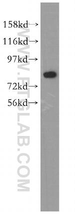 CUX1/Protein CASP Antibody in Western Blot (WB)