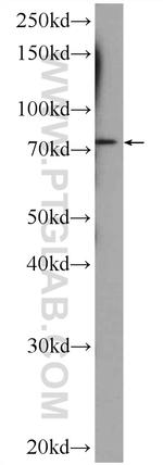 CUX1/Protein CASP Antibody in Western Blot (WB)